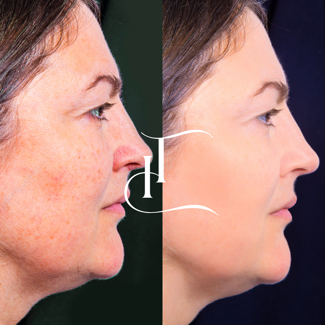 Especialista-em-Harmonizacao-Facial-19 (1)