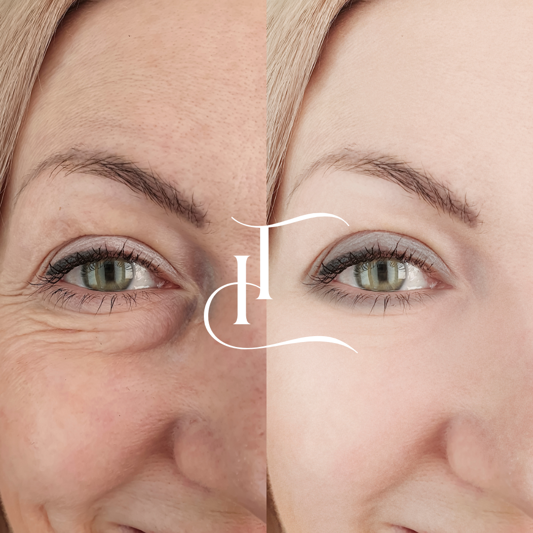 Especialista-em-Harmonizacao-Facial-2-1 (1)