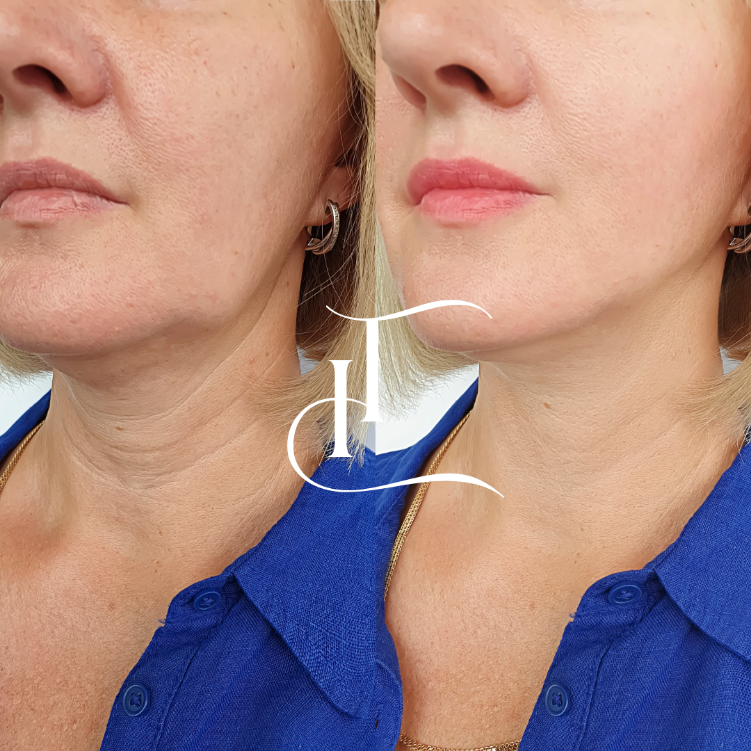 Especialista-em-Harmonizacao-Facial-5-1 (1)