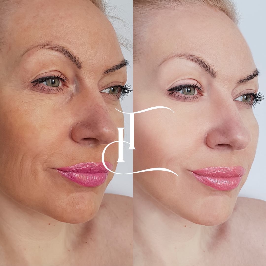 Especialista-em-Harmonizacao-Facial-6-1 (1)